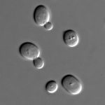 yeastS_cerevisiae_under_DIC_microscopy